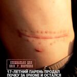 В Китае произошла история, которая звучит как мрачная притча о ценности желаний. Молодой парень решил продать свою почку…