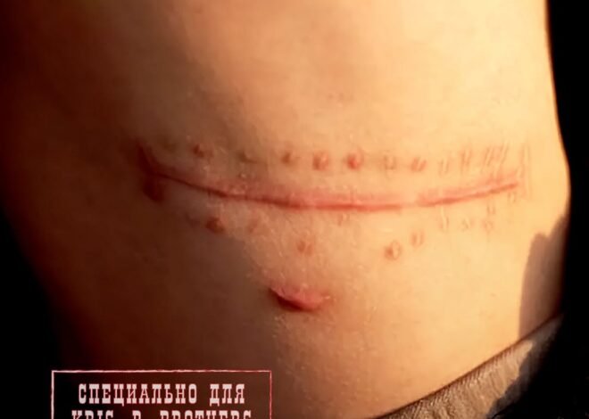 В Китае произошла история, которая звучит как мрачная притча о ценности желаний. Молодой парень решил продать свою почку…