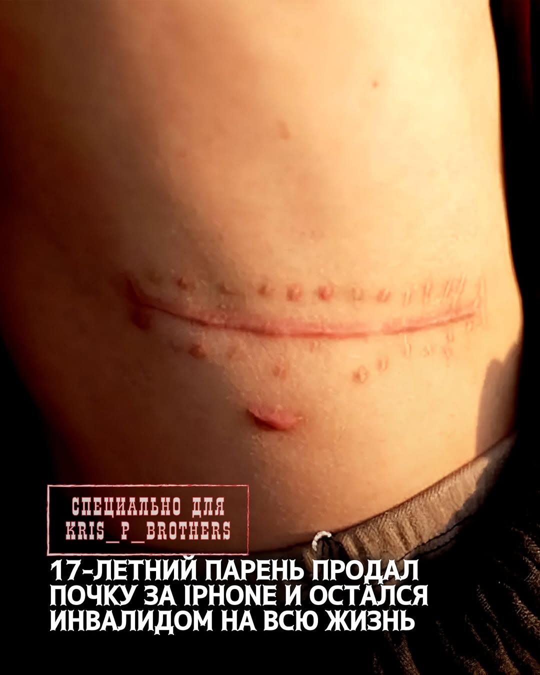 В Китае произошла история, которая звучит как мрачная притча о ценности желаний. Молодой парень решил продать свою почку…